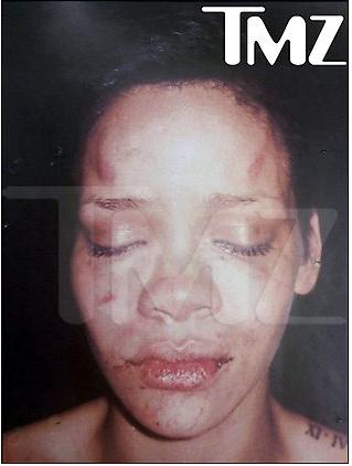 rihanna pictures beat up. Rihanna+eat+up+pics